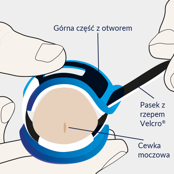 Pacey Cuff - odpowiedź na nietrzymanie moczu